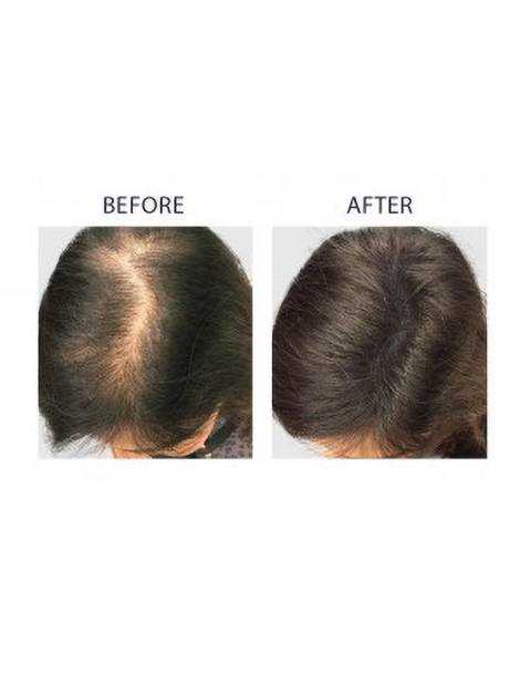Inicio Inicio NANOFIBRES Polvo para el cabello 15GR NANOGEN 23,00 EUR