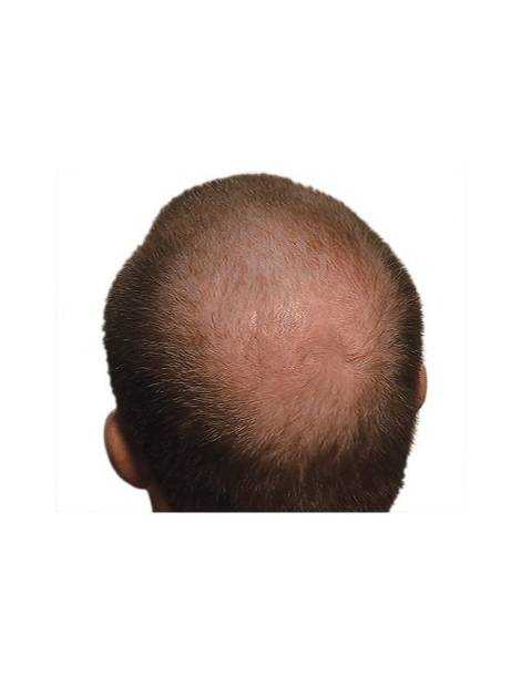 Startseite Startseite Hair Powder NANOFIBRES 15GR NANOGEN 23,00 €