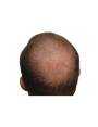 Startseite Startseite Hair Powder NANOFIBRES 15GR NANOGEN 23,00 €